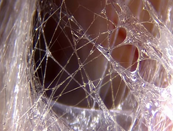 Rede fibrilar - Fáscia superficial. Endoscopia do tecido vivo. Crédito da foto: Dr. J. C. Guimberteau.